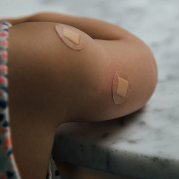 The bumps and bruises